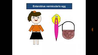 Urine Analysis 18 Enterobius vermicularis eggs [upl. by Sonya465]