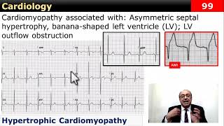 internalmedicine cme usmle محاضراتباطنة ecg كورساتباطنة clinical clinical medicine [upl. by Anitnatsnoc]