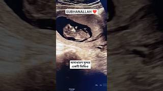 11 weeks pregnancy 🤰🍀pregnancy ultrasound reels shortvideo youtube infertility cutebaby bd [upl. by Ennayk]