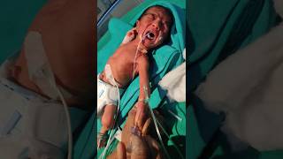 Newborn baby intracath insertion❤️shortvideotrendingviralyoutubeshortsshortsdivyaverma2401 [upl. by Petey]