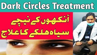 Dark circles Treatment urduhindi  How to remove dark circles  Home remedy for dark circles [upl. by Muir]