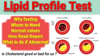 Lipid profile test Lipid profile test normal range Lipid profile test kya hota h [upl. by Hubert]