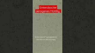 Enterobacter aerogenes Motility [upl. by Leuqar]