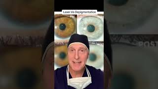 Safe to Have Eye Color Change Breaking it down for 3 procedures eyecolorchange eyecolor shorts [upl. by Ientirb]