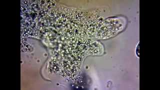 Amoeba amp Cytoplasmic Streaming [upl. by Tsenrae]