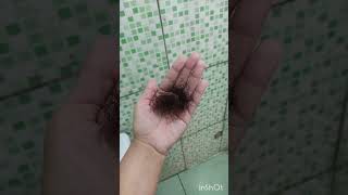 resultado 3 mês tomado lavitan mulher AZ queda de cabelo por causa dengue [upl. by Phelan]