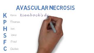 Avascular Necrosis  AVN  easy to remember mnemonic [upl. by Yrocaj350]