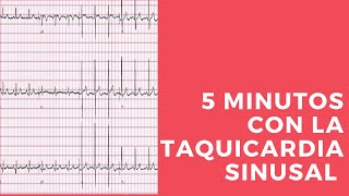 5 MINUTOS CON MI EKG TAQUICARDIA SINUSAL [upl. by Aneetak]