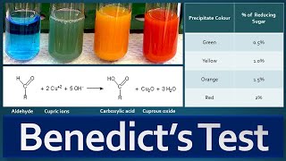 Benedicts Test Principle Procedure Preparation of Benedicts reagent and Result Interpretation [upl. by Idner]