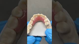 Lower Flipper Partial ​⁠EnvisiontecMain envisiontec lsk121shorts dentist teeth [upl. by Esoryram]