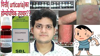 Urticaria Homeopathic medicine for Urticaria explain [upl. by Moulden]