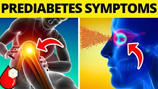 Top 15 Prediabetes Symptoms and Treatment You Need to Know Now [upl. by Eecal]