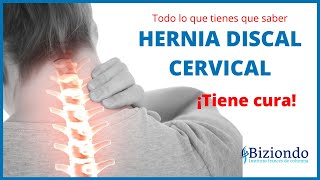 ▶ Esto es lo que tienes que saber de la HERNIA DISCAL CERVICAL◀ [upl. by Asikal]