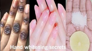 Permanent hand whitening secrets  Hand whitening secrets at home  Hand whitening secrets [upl. by Matejka]