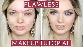 ACNE COVERAGE Flawless Foundation Makeup Tutorial  MyPaleSkin [upl. by Litta]