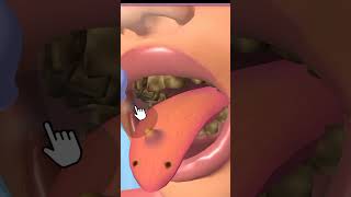 Asmr treatment treatment of tongue asmr treatment cartoon [upl. by Jennine]