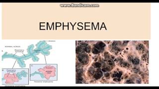 Emphysema Types Pathogenesis and morphology [upl. by Aseena]