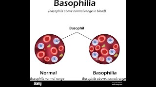 Basophilia Symptoms and Causes  Diagnosis  Treatment  Prevention [upl. by Hillegass]