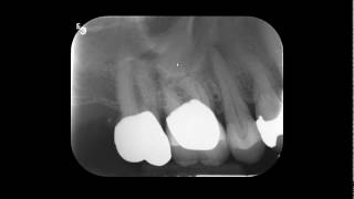 FMS Radiographic Interpretation for Dental School [upl. by Slin]