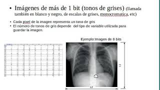 Representación de imágenes en computadora y formatos de imagen médica [upl. by Lliw]