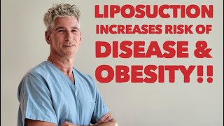 Liposuction Risk of Both Disease amp Obesity by Removing Beneficial Adiponectin Producing Good Fat [upl. by Annohsak365]