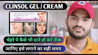 Clinsol gel how to use full review in hindi [upl. by Tasha]