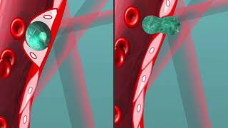 Animation of tumor cells extravasating through angiopellosis and diapedesis [upl. by Keen]