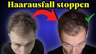 Haarausfall Stoppen Tipps für Männer [upl. by Grindlay]