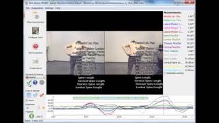 Spinal Analysis 3D segmental protocol in Simi Aktisys [upl. by Enetsirhc882]