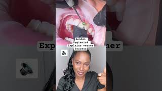 Dental hygienist reacts shorts reaction veneers [upl. by Gibun]