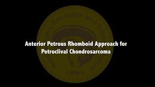 Anterior Petrous Rhomboid Approach for Petroclival Chondrosarcoma [upl. by Gnolb714]