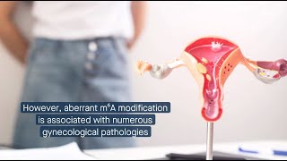 Contributions of m⁶A RNA modification to gynecological health and disease [upl. by Leavelle]