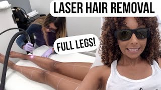 Laser Hair Removal Full Legs At LaserAway  BiancaReneeToday [upl. by Ariaj]