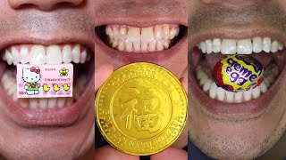 Doctor Tristan Peh Delivers Ultimate Satisfying ASMR Candy Chewing Compilation ChewUltimate [upl. by Lindholm257]