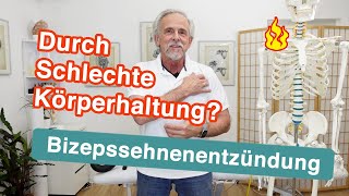 Bizepssehnenentzündung ⚡ Durch schlechte Körperhaltung  Übungen und Tipps [upl. by Clute]