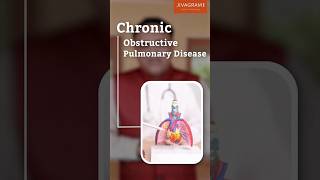 Chronic Obstructive Pulmonary Disease COPD [upl. by Yznyl]