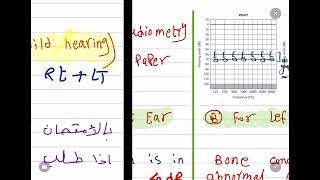 Pure tone audiometry  tympanograph [upl. by Anib]