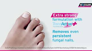 Excilor® Ultra Fungal Nail Treatment TVC [upl. by Ihsorih]