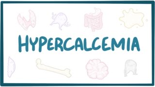 Hypercalcemia  causes symptoms diagnosis treatment pathology [upl. by Valida]