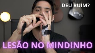 Luxação no Mindinho Minha Experiência e Dicas [upl. by Yerocaj]