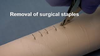 Placing and removing surgical wound closure staples [upl. by Ziul]