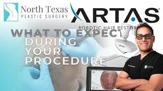 What to Expect on the Day of Your Artas Procedure  Hair Restoration [upl. by Waneta]