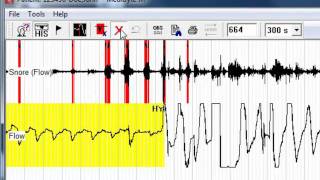 General Introduction to MediByte Jr Softwaremp4 [upl. by Assiluy]