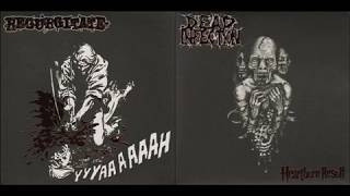 Regurgitate amp Dead Infection  Split 2009 Full Album [upl. by Jovitah]