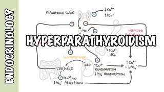 Hyperparathyroidism and the different types causes pathophysiology treatment [upl. by Yared146]