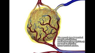 Transarterial Chemoembolization for HCC  Supplementary video ID 433409 [upl. by Anayad509]