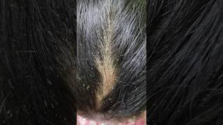 Treat Female Pattern Baldness  Uncover the secrets of ancient hair loss treatments for women [upl. by Loraine]