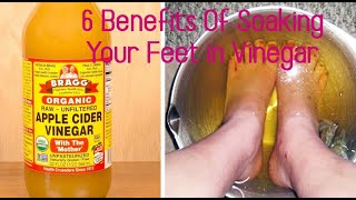 6 Benefits of Soaking Your Feet in Vinegar [upl. by Erdnael]