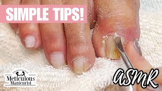 Toenail Cleaning at Home Tutorial ASMR [upl. by Bej]