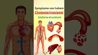 Symptome von hohem cholesterinspiegel [upl. by Sidonnie]